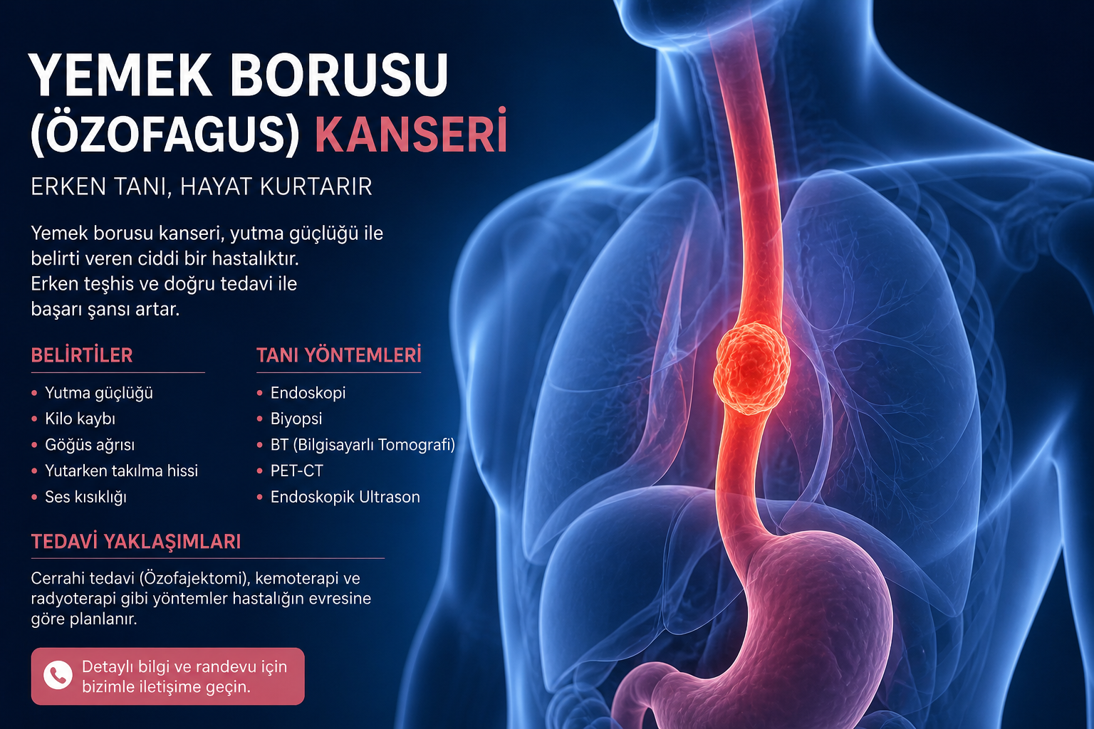Özofagus(yemek borusu) Kanseri