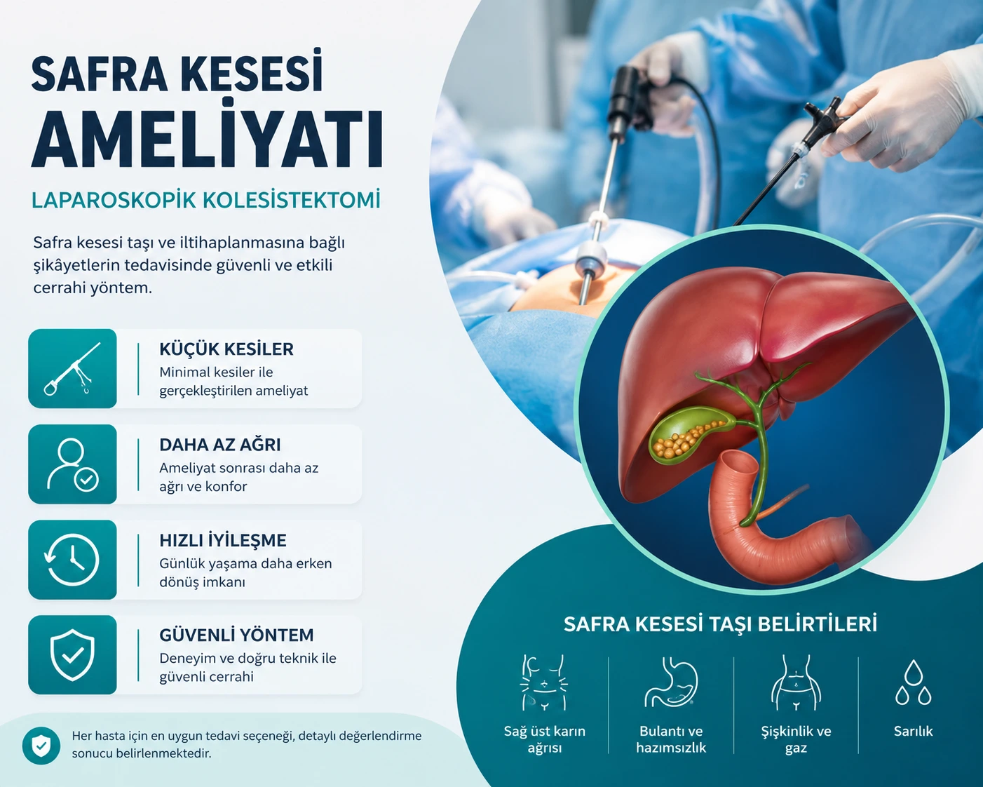 Safra Kesesi Ameliyatı Nasıl Yapılır? Laparoskopik Safra Kesesi Ameliyatı